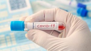 Update 5/7/2020 di Batam, Tambah 1 Kasus Baru Positif Covid-19