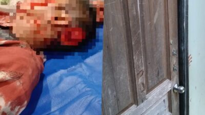 Nekat, Diduga Selisih Paham Tetangga Sendiri Dibacok
