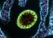72 Jam Pertama Infeksi Nipah: Apa yang Terjadi?